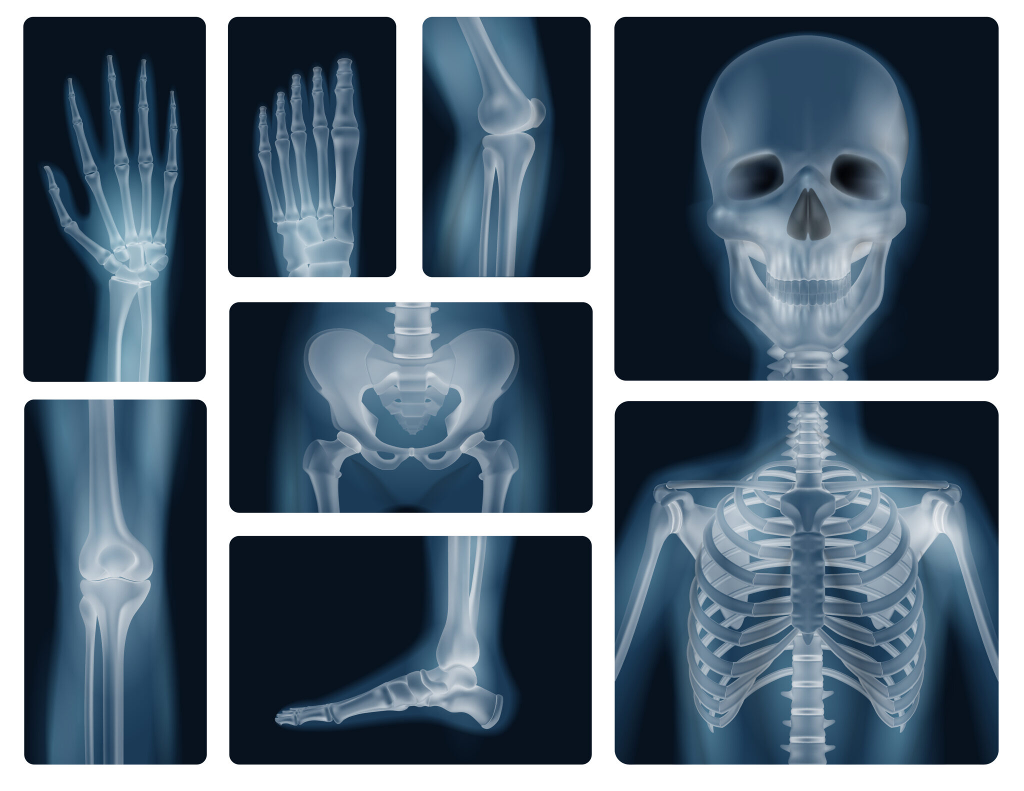 Calcio vitamina D y osteoporosis Instituto de Nutrición y Tecnología